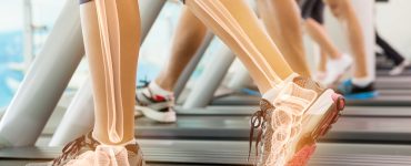 Close up of woman's legs on treadmill showing the bone outlines